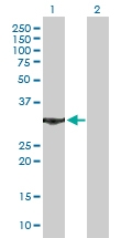 H00000308-B01P - Annexin A5 / ANXA5