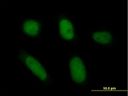 H00000308-B01P - Annexin A5 / ANXA5