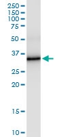 H00000308-D01 - Annexin A5 / ANXA5