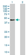 H00000310-B01P - Annexin A7 / ANXA7