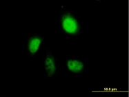 H00000310-B01P - Annexin A7 / ANXA7