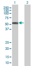H00000311-B01 - Annexin A11 / ANXA11