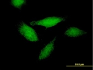 H00000311-B01 - Annexin A11 / ANXA11