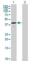 H00000312-B01P - Annexin A13 / ANXA13