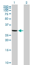 H00000319-B01 - Apolipoprotein F / Apo F