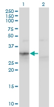 H00000319-M02 - Apolipoprotein F / Apo F