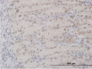 H00000328-B01P - APEX1 / REF-1