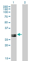 H00000335-B01P - Apolipoprotein A I / APO AI