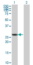 H00000335-D01P - Apolipoprotein A I / APO AI