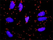 H00000335-D01P - Apolipoprotein A I / APO AI
