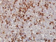 H00000336-M01 - Apolipoprotein A II / Apo AII