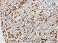 H00000336-M03 - Apolipoprotein A II / Apo AII