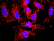 H00000351-M01 - Amyloid beta A4 protein / APP