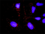 H00000354-D01P - Kallikrein-3 / PSA / KLK3