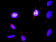 H00000356-D01P - CD178 / Fas Ligand