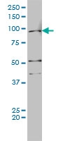 H00000367-M01 - Androgen receptor