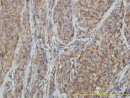 H00000387-M04 - RhoA