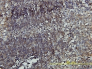 H00000387-M05 - RhoA