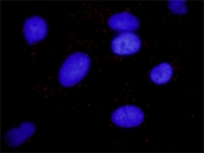 H00000409-M01 - Arrestin beta-2 / ARRB2