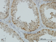 H00000439-M03 - ASNA1 / ARSA