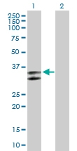 H00000462-B01P - SERPINC1 / Antithrombin-III