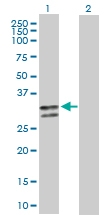 H00000462-D01P - SERPINC1 / Antithrombin-III