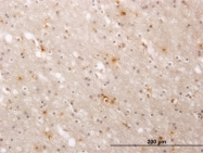 H00000487-M01 - ATP2A1 / SERCA1