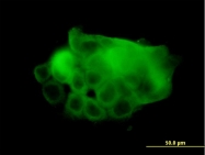 H00000487-M01 - ATP2A1 / SERCA1