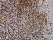 H00000489-M01 - ATP2A3 / SERCA3