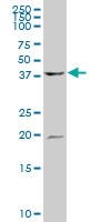 H00000528-A01 - ATP6V1C1