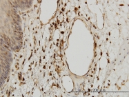 H00000567-M01 - Beta-2-microglobulin