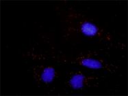 H00000567-M01 - Beta-2-microglobulin