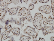 H00000581-M01 - Bax