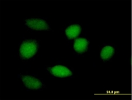 H00000644-B01P - Biliverdin reductase A