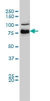 H00000673-M01A - B-Raf proto-oncogene