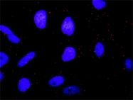 H00000673-M02 - B-Raf proto-oncogene