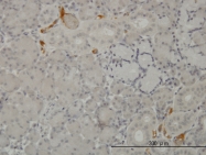 H00000718-M01 - Complement C3