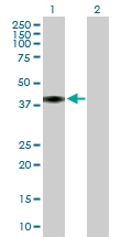 H00000725-B01P - C4b-binding protein beta