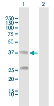 H00000725-D01 - C4b-binding protein beta