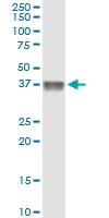 H00000725-D01 - C4b-binding protein beta