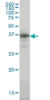 H00000767-M01 - Carbonic anhydrase 8