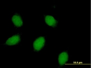 H00000793-D01P - Calbindin