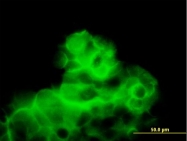 H00000799-B01P - Calcitonin receptor