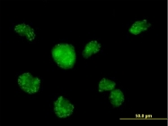 H00000810-B02P - Calmodulin-like protein 3
