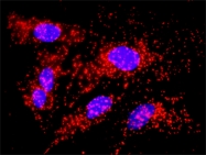 H00000811-D01P - Calreticulin