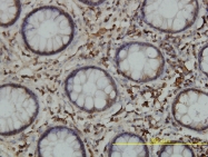 H00000811-M01 - Calreticulin
