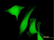 H00000813-B01P - Calumenin