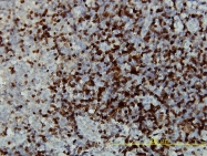 H00000814-M01 - CAMK4