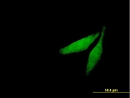 H00000818-B02P - CAMK2G / CAMKG