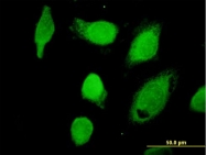 H00000823-B01P - Calpain-1